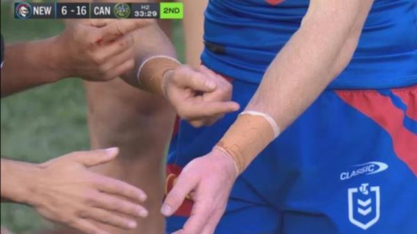 “我们握手了”：杰克·怀特顿在史诗级的淘汰赛决赛中被指控咬伤，直接被送上了法庭