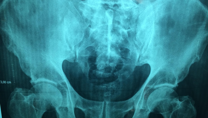 玩家必看教程“开心段子手到底有没有挂”开挂(透视)辅助教程 玩家必看教程“开心段子手到底有没有挂”开挂(透视)辅助教程