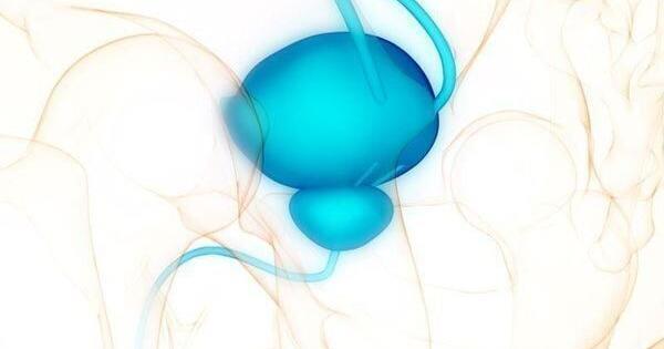 良性前列腺增生的患病率在全球范围内不断上升