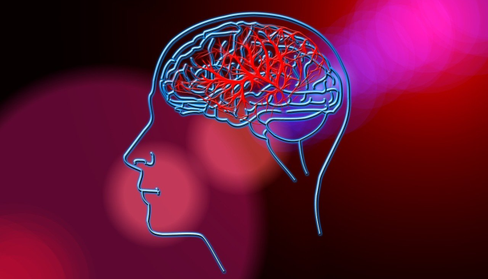 COVID-19治疗的缺血性中风患者大脑出血 COVID-19治疗的缺血性中风患者大脑出血