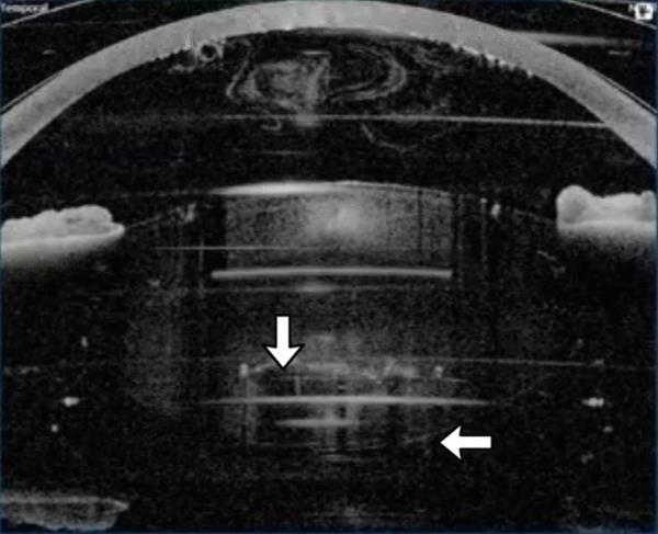 笨手笨脚的熊宝宝爪子卡在树上,佛罗里达警察拿出洗洁精 笨手笨脚的熊宝宝爪子卡在树上,佛罗里达警察拿出洗洁精