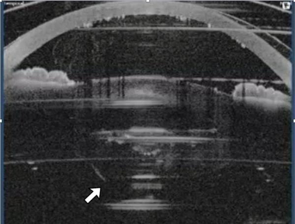 万能开挂辅助“潮汕汇app开挂!详细分享装挂步骤